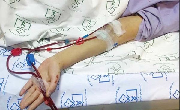 
بیماران پیوندی در معرض خطر رد عضو